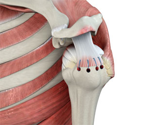 Rotator Cuff